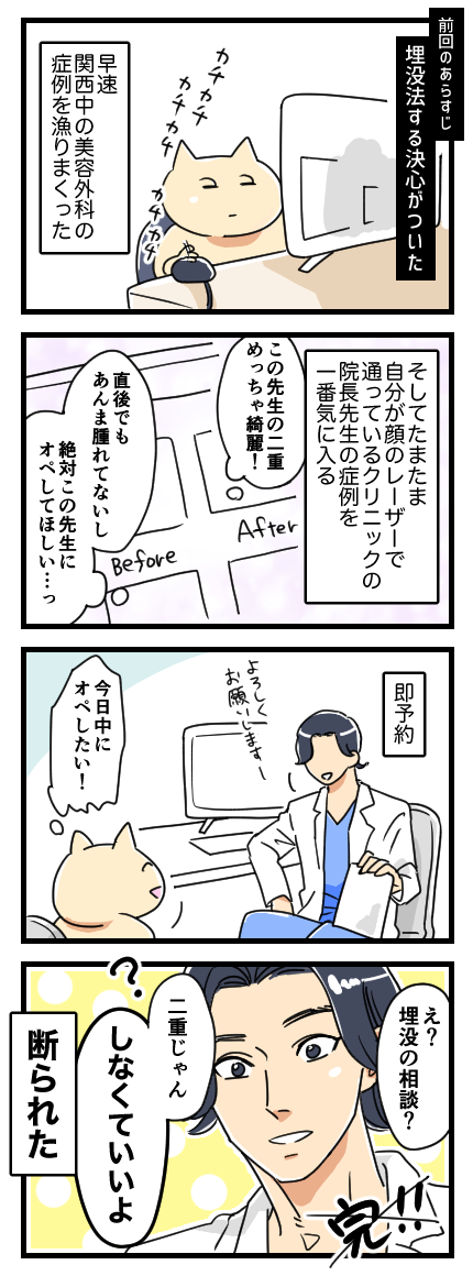 二重なのに埋没法をした話