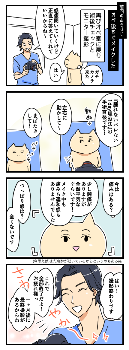 二重なのに埋没法をした話