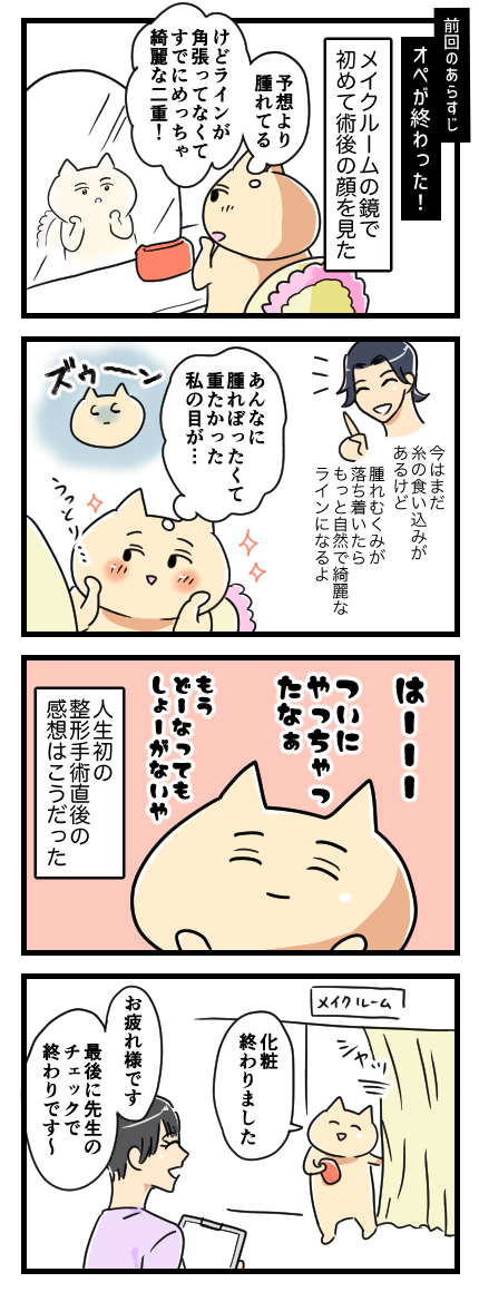 二重なのに埋没法をした話