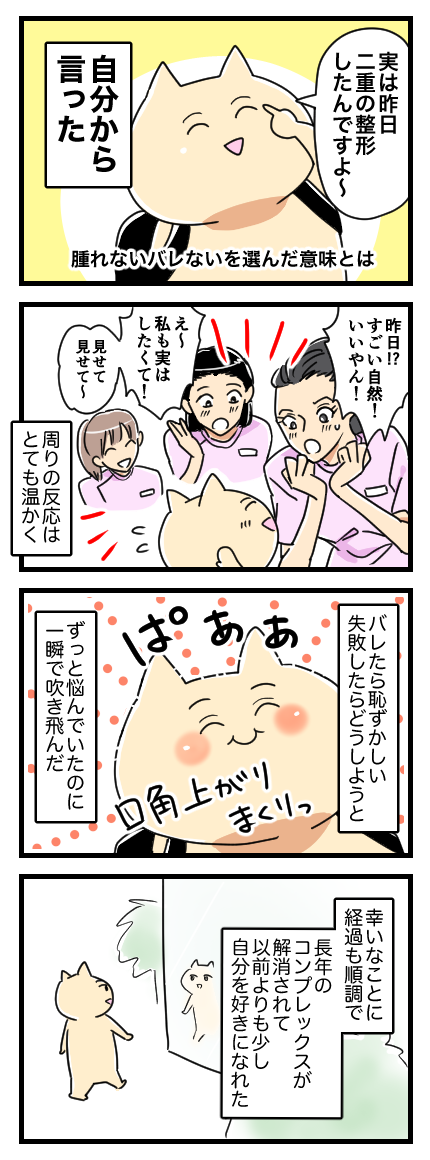 二重なのに埋没法をした話