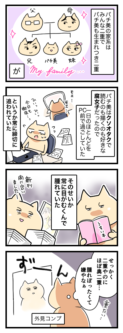 二重なのに埋没法をした話