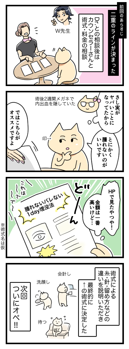 二重なのに埋没法をした話