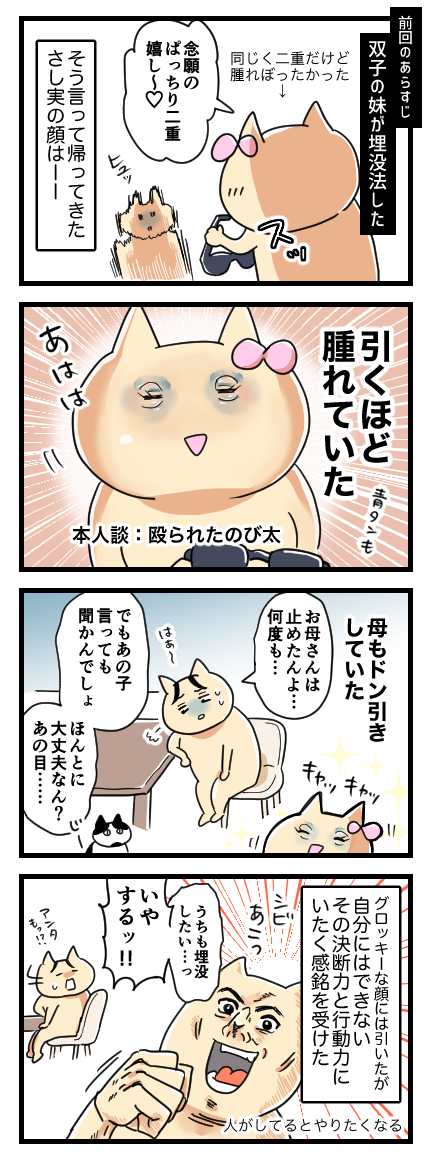 二重なのに埋没法をした話